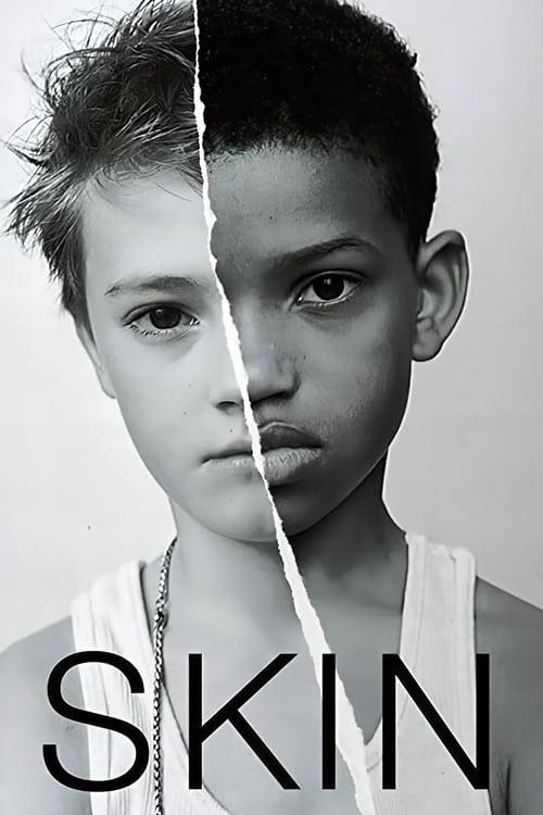 Skin Poster